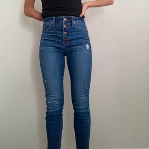 Madewell Button Jeans
